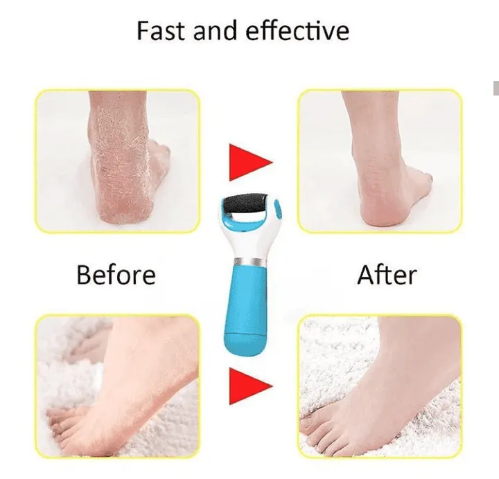 Electric Foot Filer Dry Foot Filer